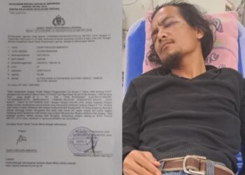 Ambarita Jurnalis Jadi Korban Penganiayaan Saat Liputan, Kasus Dilaporkan Ke Polda Metro Jaya