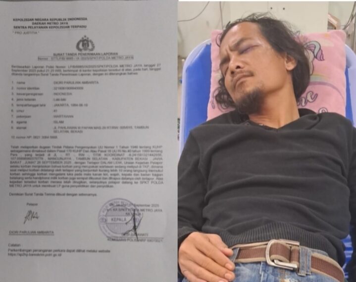 Ambarita Jurnalis Jadi Korban Penganiayaan Saat Liputan, Kasus Dilaporkan Ke Polda Metro Jaya