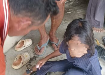 Miris!!! Bocah 5 Tahun Ditemukan Didalam Rumah Dirantai Oleh Ibu Kandung dan Ayah Tiri